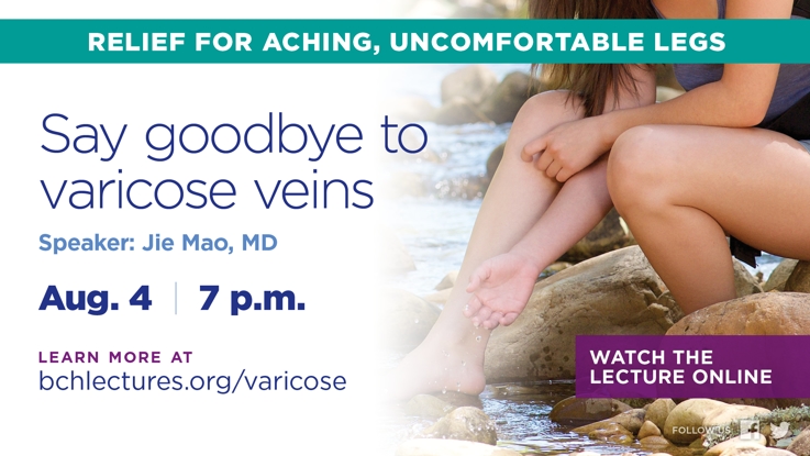 Say Goodbye to Varicose Veins